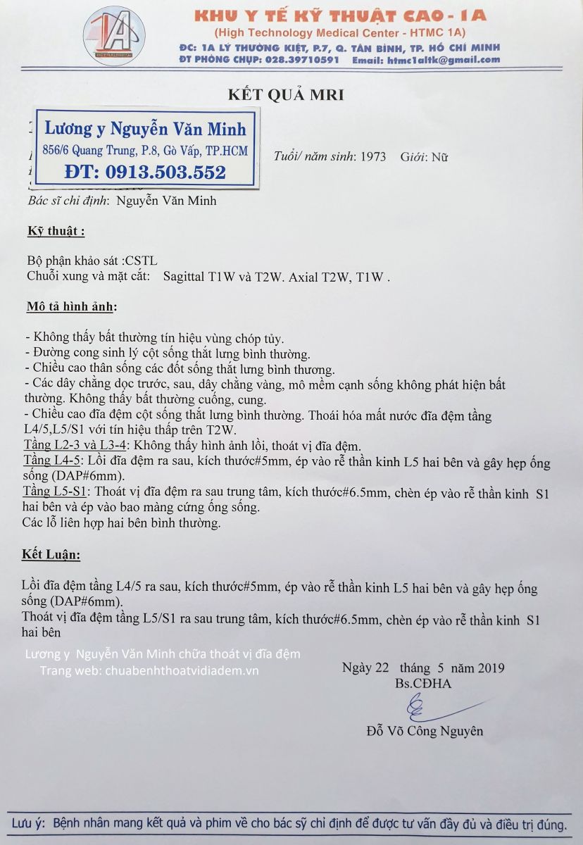 Thoát vị đĩa đệm cột sống thắt lưng